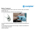 Cryolipolysis Slimming for Weight Loss Fat Freezing Reduction